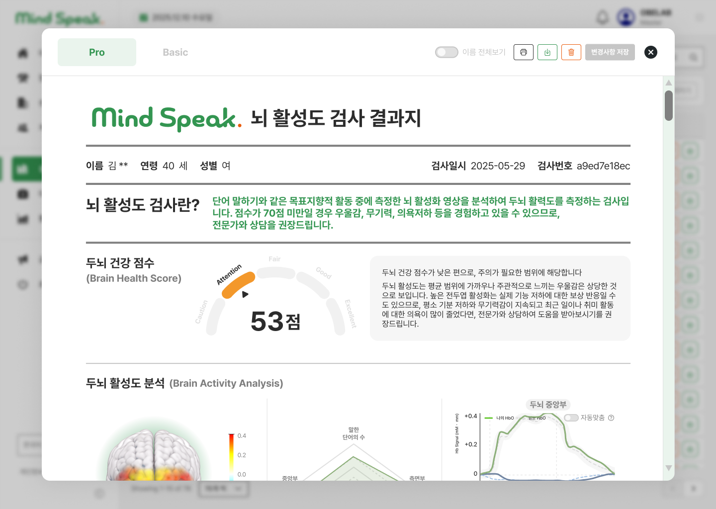 뇌 건강 점수, brain map, 레이더 차트와 HbO 시계열을 함께 제공하는 실제 Pro 결과지 화면